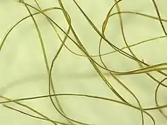 Détail d'un Byssus.