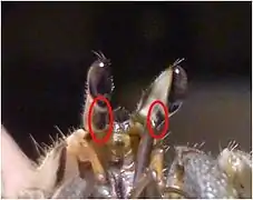 Taches noirs sous les yeux