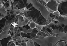 image DDC-SEM d'une particule calcifiée dans le tissu cardiaque - Signal 1 : SE