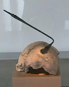 Crâne trépané (IIe siècle av. J.-C.) découvert à proximité de la porte Est de l'oppidum de Manching.