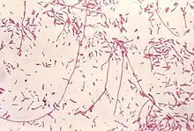 Coloration de Gram de Legionella pneumophila