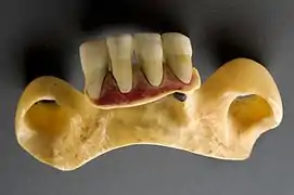 Prothèse en hippopotame