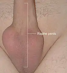 Photographie d'un autre pénis humain en érection.