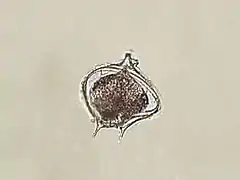 Protoperidinium depressum (Protoperidiniaceae).