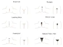 Graphique montrant différentes formes de poils pubiens
