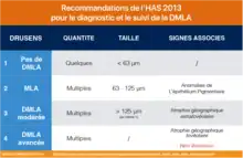 Recommandations de l’HAS 2013 pour le diagnostic et le suivi de la DMLA