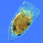 Favella sp. (Ptychocylididae).