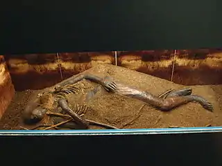 Enfant de Windeby, Allemagne.