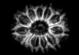 Radiographie d'Elaeocarpus ganitrus révélant 10 locules porteuses de graines à l'intérieur