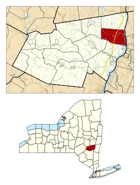 Localisation de Coxsackie