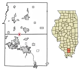 Localisation de Freeman Spur